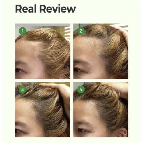 [Daeng Gi Meo Ri] Ki Gold Premium Treatment (2 Tamaños) - Imagen 4